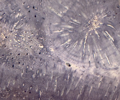 Microscopic view of bone tissue.